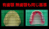 入れ歯のかみ合わせは大事