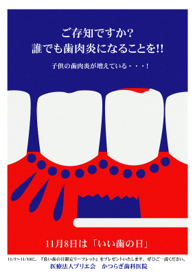 ご存知ですか?誰でも歯肉炎になることを!!子供の歯肉炎が増えている・・・!